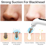 Vacuum Pore Cleaner – 6-in-1 Blackhead Remover for Clear & Healthy Skin